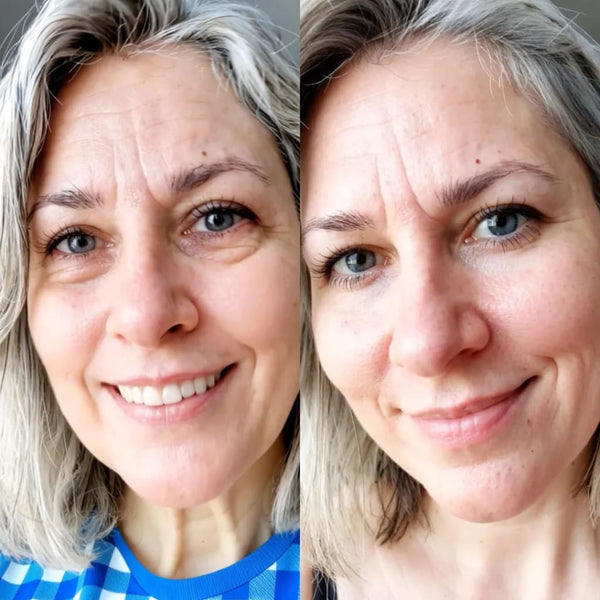 RevitalEyes® 2-in-1 Red Light Therapy + EMS To Erase Eye Bags