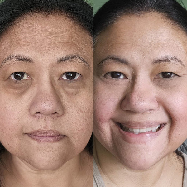 RevitalEyes® 2-in-1 Red Light Therapy + EMS To Erase Eye Bags