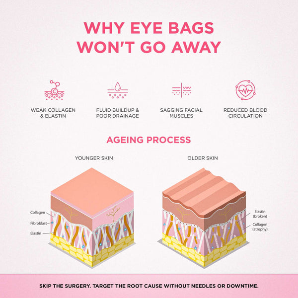 RevitalEyes® 2-in-1 Red Light Therapy + EMS To Erase Eye Bags