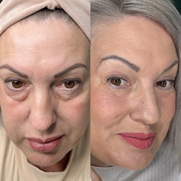 RevitalEyes® 2-in-1 Red Light Therapy + EMS To Erase Eye Bags